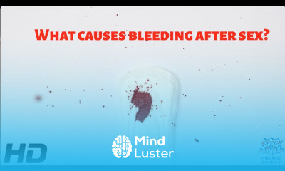 Learn What Causes Bleeding After Sex Mind Luster