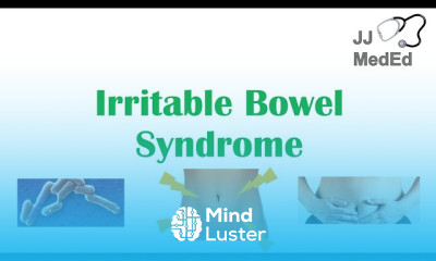 Irritable Bowel Syndrome Treatment