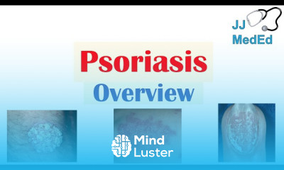 Vesiculobullous Skin Diseases Treatment