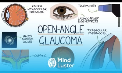 Bitemporal Hemianopia Diagnosis