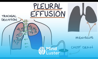 Bronchiolitis Diagnosis