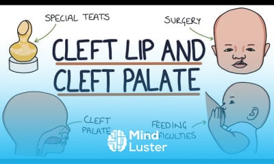 Acoustic Neuromas Diagnosis