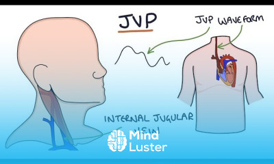 Jugular Venous Pressure Diagnosis