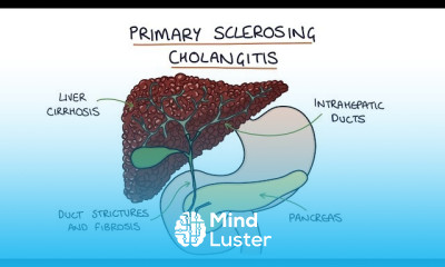 Haemochromatosis Diagnosis