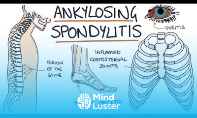 Psoriatic Arthritis Diagnosis