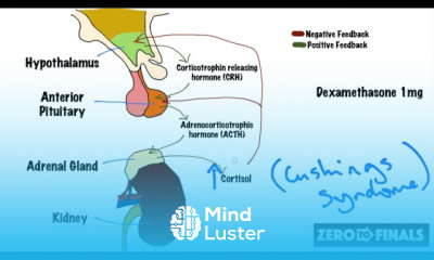 Ankle Brachial Pressure Index