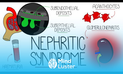 Chronic Kidney Disease Diagnosis