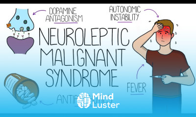 Neuroleptic Malignant Syndrome Diagnosis
