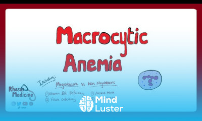 Megaloblastic Anemia Treatment