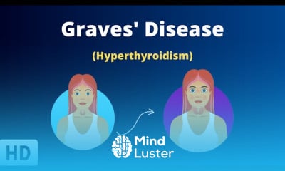 Thyroid Nodules Symptoms and Treatment