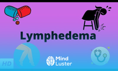 Lymphedema Symptoms and Treatment