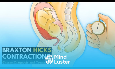 Braxton Hicks contractions Symptoms