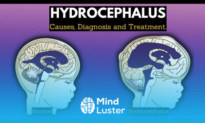 Irritant Diaper Dermatitis Symptoms