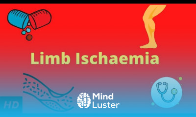 Limb Ischaemia Symptoms and Treatment