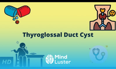 Diabetes Insipidus Symptoms and Treatment