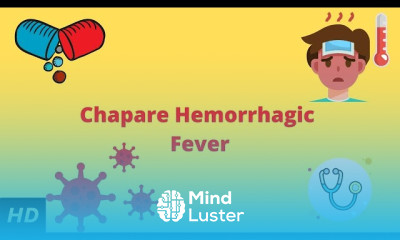 Herpes Zoster Symptoms and Treatment