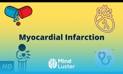 Myocardial Infarction Symptoms and Treatment