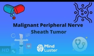 Angiomyolipoma Symptoms and Treatment