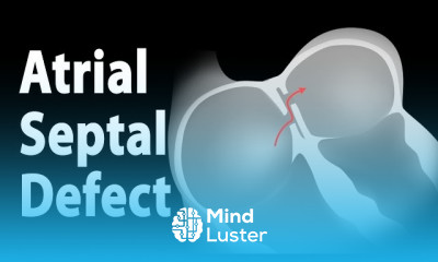 Cardiac Tamponade Symptoms and Diagnosis