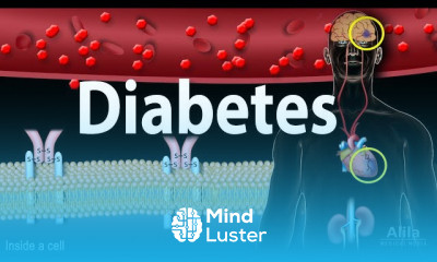 Diabetes mellitus Symptoms and Complication