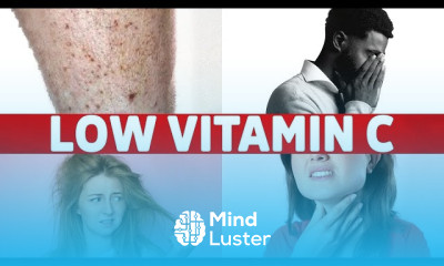 Vitamin C Deficiency Symptoms