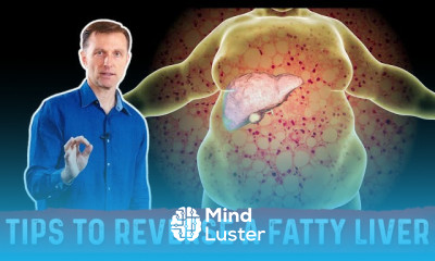 Fatty Liver Treatment Strategies