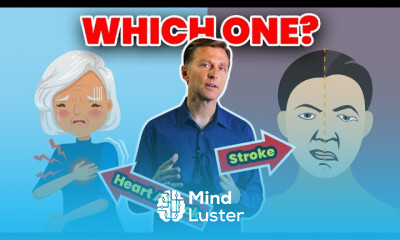 Diet For Heart Attack and Stroke