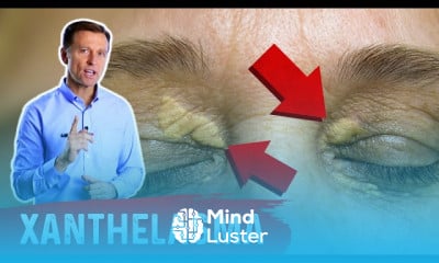 Right Ankle Edema Causes