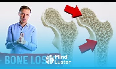 Benefits of Plank Exercises on Bones Health