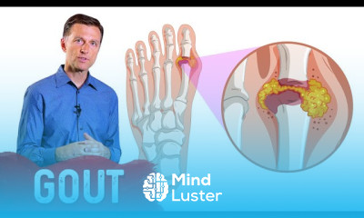 Natural remedies for gout attacks