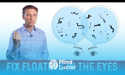 Bloodshot Eyes Causes and Treatment