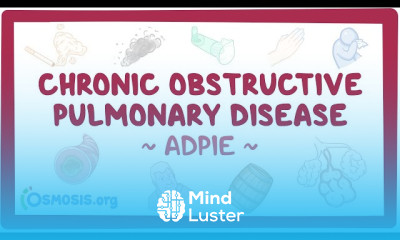 Trigeminal Neuralgia symptoms and treatment