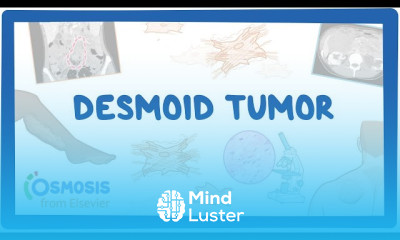 Focal Segmental Glomerulosclerosis symptoms