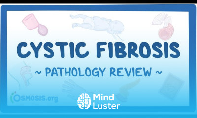 Respiratory distress syndrome Treatment