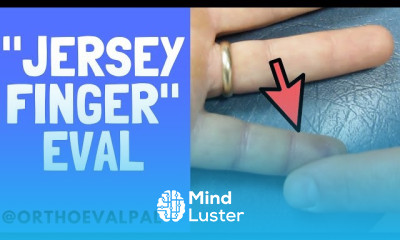 Carpal Tunnel Syndrome Treatment