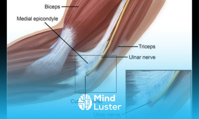Cubital Tunnel Syndrome Signs and Treatment