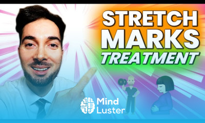 Remove Dark Circles Under Eyes and Treatment