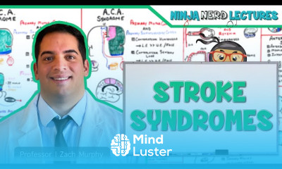 Acute Ischemic Stroke diagnostics