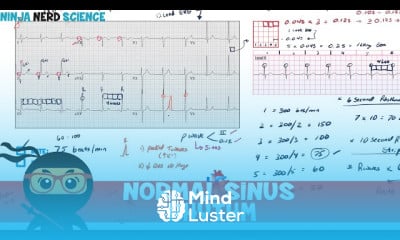 Ventricular Tachycardia Pharmacological
