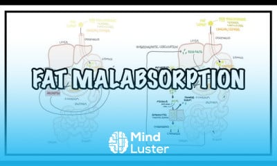 Fat malabsorption signs and symptoms