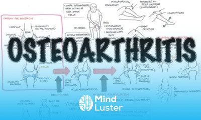 Kawasaki Disease vasculitis symptoms