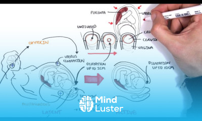 Infertility in Women causes