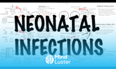 Coeliac Disease symptoms and treatment
