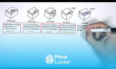 Melanoma symptoms and treatment