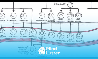 Multiple Myeloma signs and treatment