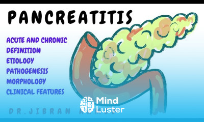 Acute Pancreatitis Diagnosis