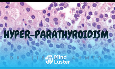 Hyper adrenalism Diagnosis