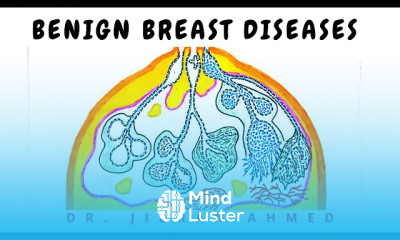 Benign Breast disease symptoms