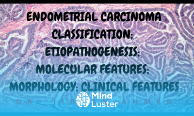 Cervical Carcinoma treatment modalities