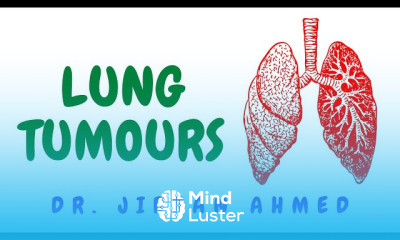 Lung tumors treatment modalities